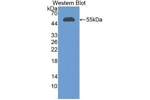 Western blot analysis of recombinant Human CFI. (Complement Factor I 抗体  (AA 28-243))