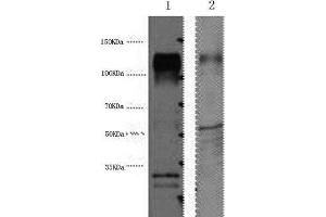 Western Blot analysis of 1) Hela, 2) Mouse brain using ERBB2 Monoclonal Antibody at dilution of 1:4000. (ErbB2/Her2 抗体)