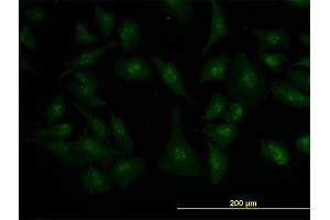 Immunofluorescence (IF) image for anti-Zic Family Member 4 (ZIC4) (AA 249-319) antibody (ABIN529568)