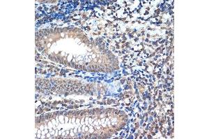 Immunohistochemistry (IHC) image for anti-REST Corepressor 1 (RCOR1) antibody (ABIN7269920)