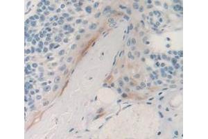 IHC-P analysis of Human Tissue, with DAB staining. (PSCA 抗体  (AA 22-123))