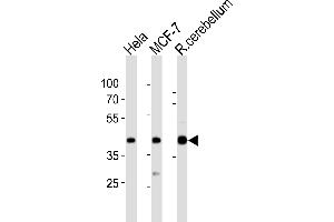 Western blot analysis of lysates from Hela, MCF-7 cell line, rat cerebellum tissue lysate(from left to right), using LTM4B Antibody (4) 20871a. (LAPTM4B 抗体  (AA 195-209))