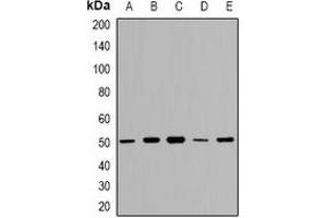 Western blot analysis of GDI2 expression in A549 (A), HT29 (B), K562 (C), mouse kidney (D), mouse lung (E) whole cell lysates. (GDI2 抗体  (C-Term))