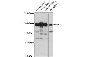 Western blot analysis of extracts of various cell lines, using ELP2 antibody (ABIN7266926) at 1:1000 dilution. (ELP2 抗体  (AA 300-600))