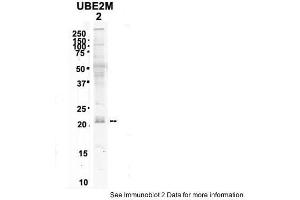 Sample Type:2. (UBE2M 抗体  (N-Term))