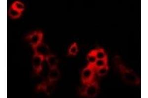 Immunofluorescent analysis of MKK5 staining in U2OS cells. (MAP2K5 抗体)