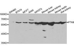 Western blot analysis of extracts of various cell lines, using PTK6 antibody. (PTK6 抗体)