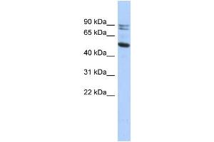 WB Suggested Anti-CAPN10 Antibody Titration: 0. (CAPN10 抗体  (N-Term))
