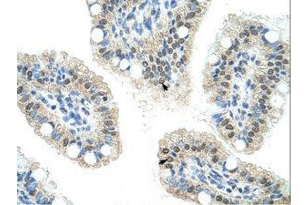 Nucleolar Protein 6 抗体  (C-Term)