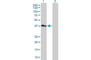 Western Blot analysis of PDCD2L expression in transfected 293T cell line by PDCD2L MaxPab polyclonal antibody. (PDCD2L 抗体  (AA 1-358))