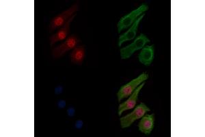 ABIN6256220 and ABIN6267281 staining HepG2 cells(30 min of 4uM Forskolin treatment) by IF/ICC. (RAF1 抗体  (pSer259))