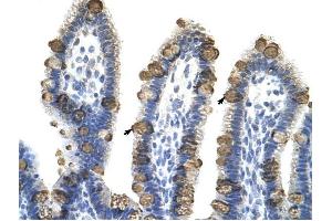 EXOSC3 antibody was used for immunohistochemistry at a concentration of 4-8 ug/ml to stain Epithelial cells of intestinal villus (arrows) in Human Intestine. (EXOSC3 抗体  (Middle Region))