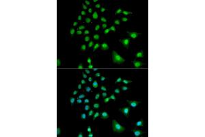 Immunofluorescence analysis of U2OS cells using UBE3C antibody. (UBE3C 抗体)