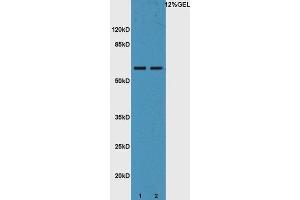 Lane 1: mouse liver lysates Lane 2: mouse intestine probed with Rabbit Anti-IL-22R Polyclonal Antibody, Unconjugated  at 1:5000 for 90 min at 37˚C. (IL22 Receptor alpha 1 抗体  (AA 41-150))