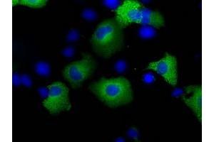 Image no. 7 for anti-Transforming, Acidic Coiled-Coil Containing Protein 3 (TACC3) antibody (ABIN1498098) (TACC3 抗体)