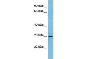 WB Suggested Anti-RAB6C Antibody Titration: 1. (WTH3DI 抗体  (C-Term))