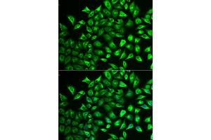 Immunofluorescence analysis of U2OS cells using MMRN1 antibody (ABIN5974009). (Multimerin 1 抗体)