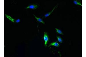 Immunofluorescent analysis of Hela cells using ABIN7166225 at dilution of 1:100 and Alexa Fluor 488-congugated AffiniPure Goat Anti-Rabbit IgG(H+L) (TTYH1 抗体  (AA 50-178))