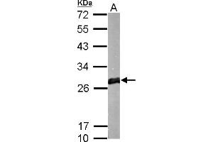 WB Image GSTM1 antibody detects protein by Western blot analysis. (GSTM1 抗体)