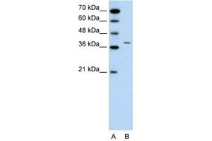 RAPSN antibody used at 0. (RAPSN 抗体  (N-Term))