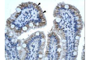 Image no. 1 for anti-Gap Junction Protein, beta 1, 32kDa (GJB1) (C-Term) antibody (ABIN202156) (GJB1 抗体  (C-Term))