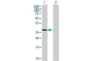 Lane 1: NEK7 transfected lysate ( 33. (NEK7 293T Cell Transient Overexpression Lysate(Denatured))