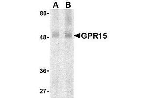 Western blot analysis of GPR15 in human spleen lysate with AP30376PU-N GPR15 antibody at (A) 0. (GPR15 抗体  (N-Term))