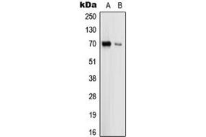 Western blot analysis of Uromodulin expression in HEK293T (A), THP1 (B) whole cell lysates. (Uromodulin 抗体  (Center))