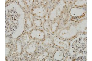 Immunoperoxidase of monoclonal antibody to MEOX2 on formalin-fixed paraffin-embedded human kidney.