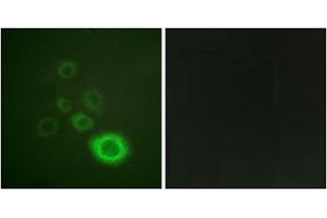 Immunofluorescence analysis of A549 cells, using c-Met (epitope around residue 1003) antibody. (c-MET 抗体  (Tyr1003))