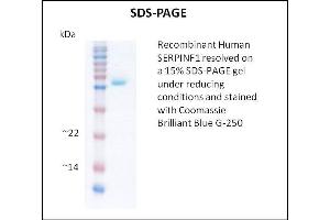 SDS-PAGE (SDS) image for serpin Peptidase Inhibitor, Clade F (Alpha-2 Antiplasmin, Pigment Epithelium Derived Factor), Member 1 (SERPINF1) (Active) protein (ABIN5509380) (PEDF 蛋白)