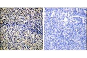 Immunohistochemistry analysis of paraffin-embedded human tonsil tissue, using p47 phox (Ab-328) Antibody. (NCF1 抗体  (AA 301-350))