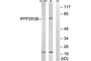 Western blot analysis of extracts from Jurkat/HuvEc cells, using PPP2R5D Antibody. (PPP2R5D 抗体  (AA 544-593))