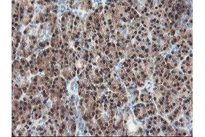 Immunohistochemical staining of paraffin-embedded Human pancreas tissue using anti-PGM3 mouse monoclonal antibody. (Phosphoglucomutase 3 抗体)