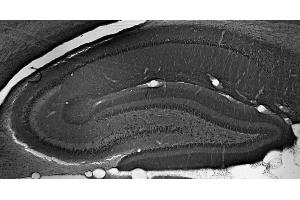 Adult rat hippocampus immunohistochemistry. (Peroxisomal Biogenesis Factor 5-Like (PEX5L) (AA 1-192), (Constant Region) 抗体)