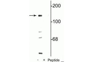 Western blot of mouse brain lysate showing specific immunolabeling of the ~140 kDa NR2C   subunit of the NMDA receptor phosphorylated at Ser1096 in the first lane (-). (GRIN2C 抗体  (pSer1096))