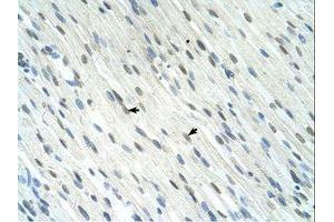 Image no. 1 for anti-SERTA Domain Containing 1 (SERTAD1) (N-Term) antibody (ABIN324352) (SERTAD1 抗体  (N-Term))