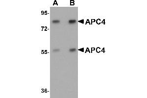 Western Blotting (WB) image for anti-Anaphase Promoting Complex Subunit 4 (ANAPC4) (N-Term) antibody (ABIN1031231) (ANAPC4 抗体  (N-Term))