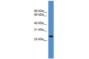WB Suggested Anti-CD28 Antibody Titration: 0. (CD28 抗体  (C-Term))