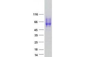 Validation with Western Blot