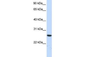 WB Suggested Anti-TTC33 Antibody Titration: 0. (TTC33 抗体  (N-Term))