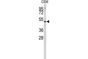 Western Blotting (WB) image for anti-Carnosine Dipeptidase 1 (Metallopeptidase M20 Family) (CNDP1) antibody (ABIN3004062)