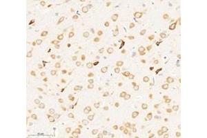 Immunohistochemistry analysis of paraffin-embedded rat brain using,RPL8 (ABIN7075442) at dilution of 1: 3000 (RPL8 抗体)