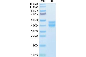 Mouse BST1 on Tris-Bis PAGE under reduced condition. (BST1 Protein (AA 25-286) (His tag))