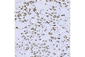 IHC analysis of VPRBP/DCAF1 using anti-VPRBP/DCAF1 antibody (ABIN7602005). (DDB1 and CUL4-Associated Factor 1 (DCAF1) (AA 540-861) 抗体)