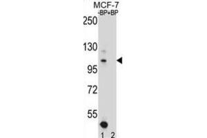 Western Blotting (WB) image for anti-Homeodomain Interacting Protein Kinase 1 (HIPK1) antibody (ABIN2996765) (HIPK1 抗体)