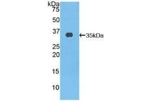 Detection of Recombinant ABCA3, Human using Polyclonal Antibody to ATP Binding Cassette Transporter A3 (ABCA3) (ABCA3 抗体  (AA 1358-1635))