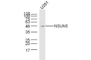 U251 lysates probed with NSUN5 Polyclonal Antibody, Unconjugated  at 1:300 dilution and 4˚C overnight incubation. (NSUN5 抗体  (AA 2-100))