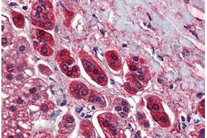 Human Adrenal (formalin-fixed, paraffin-embedded) stained with TCF21 antibody ABIN462190 followed by biotinylated goat anti-rabbit IgG secondary antibody ABIN481713, alkaline phosphatase-streptavidin and chromogen. (TCF21 抗体  (AA 42-91))