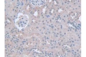 Detection of IFNg in Rat Kidney Tissue using Polyclonal Antibody to Interferon Gamma (IFNg) (Interferon gamma 抗体  (AA 23-156))
